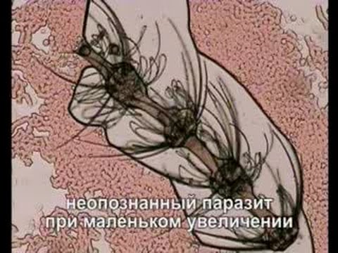 Гемосканирование - лохотронный метод обследования