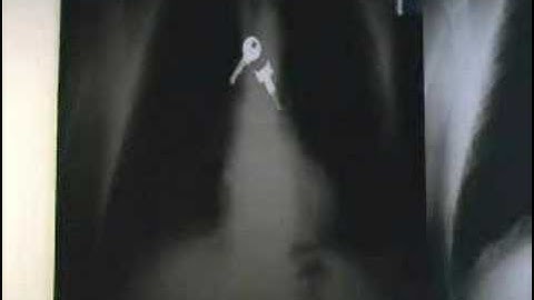 Greys Anatomy - Somewhere Only We Know