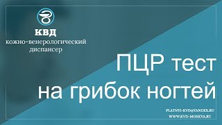 276  ПЦР тест на грибок ногтей