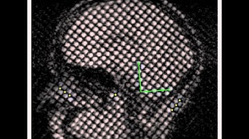 Quantitative Imaging Methods for the Development & Validation of Brain Biomechanics Models: Video 2