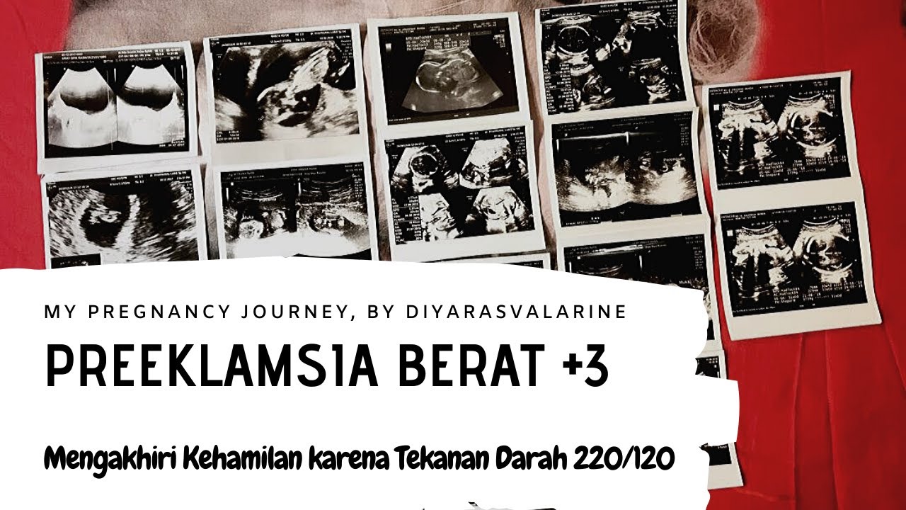 My Pregnancy Journey - Preeklamsia Berat +3