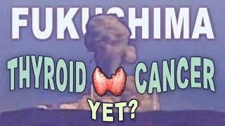 Fukushima Thyroid Cancer?