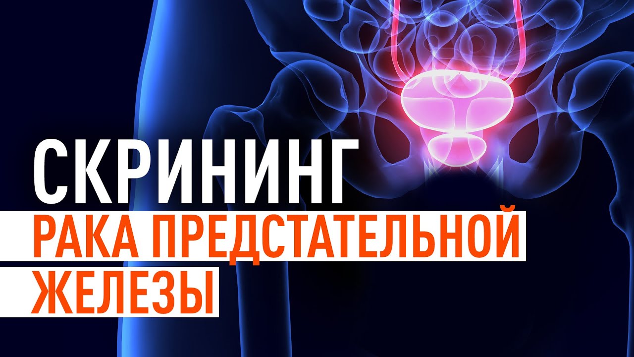 Скрининг простаты. Как не пропустить рак предстательной железы? - YouTube