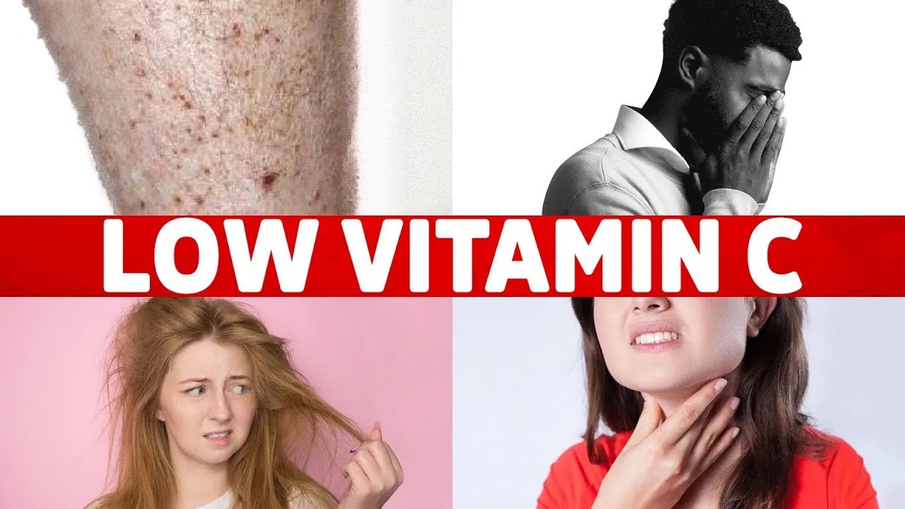 8 Signs Of A Vitamin C Deficiency You Ve Never Heard About Youtube