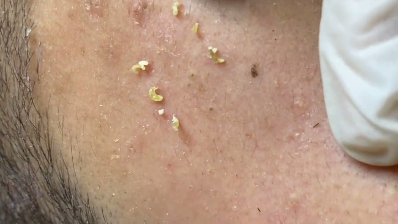 Skincare satisfying videos by Mahmoud gamal