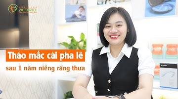 Tháo mắc cài pha lê sau 1 năm niềng răng thưa - KH Hồ Thu Trang