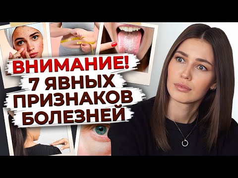 Внешний вид и здоровье / Как узнать о болезни по внешним признакам?