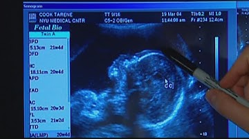 FDA issues warning over non-invasive prenatal screenings