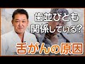 歯並びとも関係している?舌がんの原因
