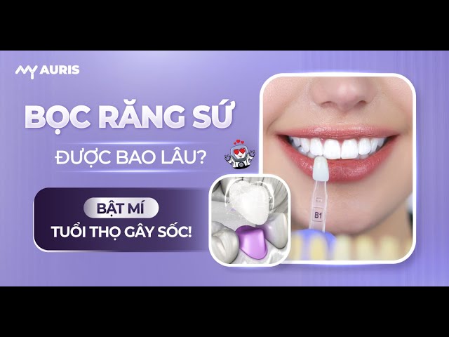 Outline Video Bọc răng sứ được bao lâu? Bật mí tuổi thọ gây SỐC!