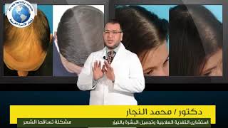 علاج تساقط الشعر نهائياً عند الرجال والسيدات مع الدكتور محمد النجار
