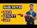 Hair patch price|hair wig price, quality and life explained in hindi.