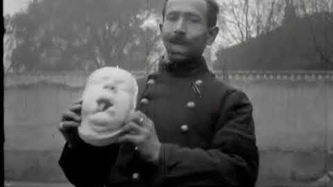 Première Guerre mondiale : soigner les "gueules cassées"