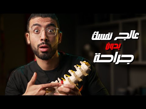 5 أسرار لعلاج الانزلاق الغضروفي القطني دون الحاجة للجراحة