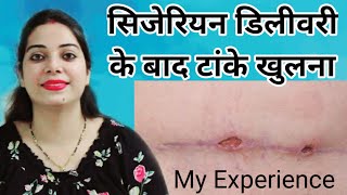 Cesarean delivery k bad tanke khulna|| Hole in stitches || My experience in hindi || IndianMomsNest