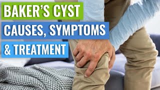 Baker’s Cyst Causes, Symptoms, Treatment (Conservative vs. Surgery)