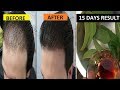 अमरुद की पत्तियों से बाल  झड़ना बंद करने और तेज़ी से बाल उगाने का रामबांड घरेलु नुस्खा  | Herbal Maza
