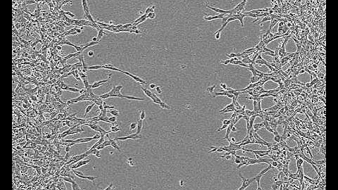 HT 1080 cells invading 3D ECM on IncuCyte