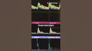 Macroscopic vs Microscopic Approach in Thermodynamics 🔥 | Quick Explanation!