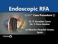 Endoscopic rfa elra benign ablation case procedure by dr p gonzlez carro in spain