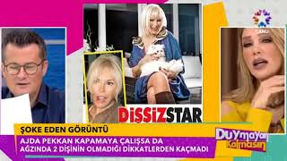 Ajda Pekkandan Şoke Eden Görüntü Di̇şsi̇z Süperstar