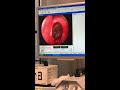 In-Office Balloon Dilation Right Sphenoid Sinus with minimal discomfort