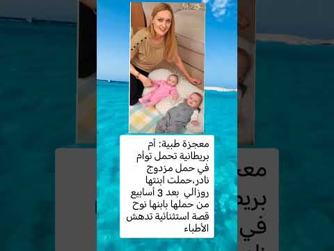 معجز ةطبية أم بريطانية تحمل توأم في حمل مزدوج لايك اشتراك اكسبلور ترند معلومات العظماء