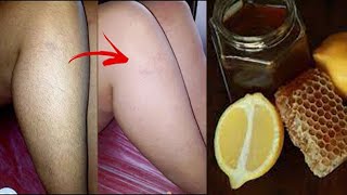 Get rid of unwanted hair from the face and body without pain just in 5 minutes