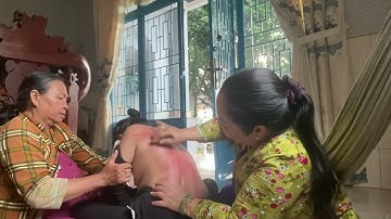 cô tám cạo gió cục vàng nhõng nhẽo@￼ Châu Thành An Giang