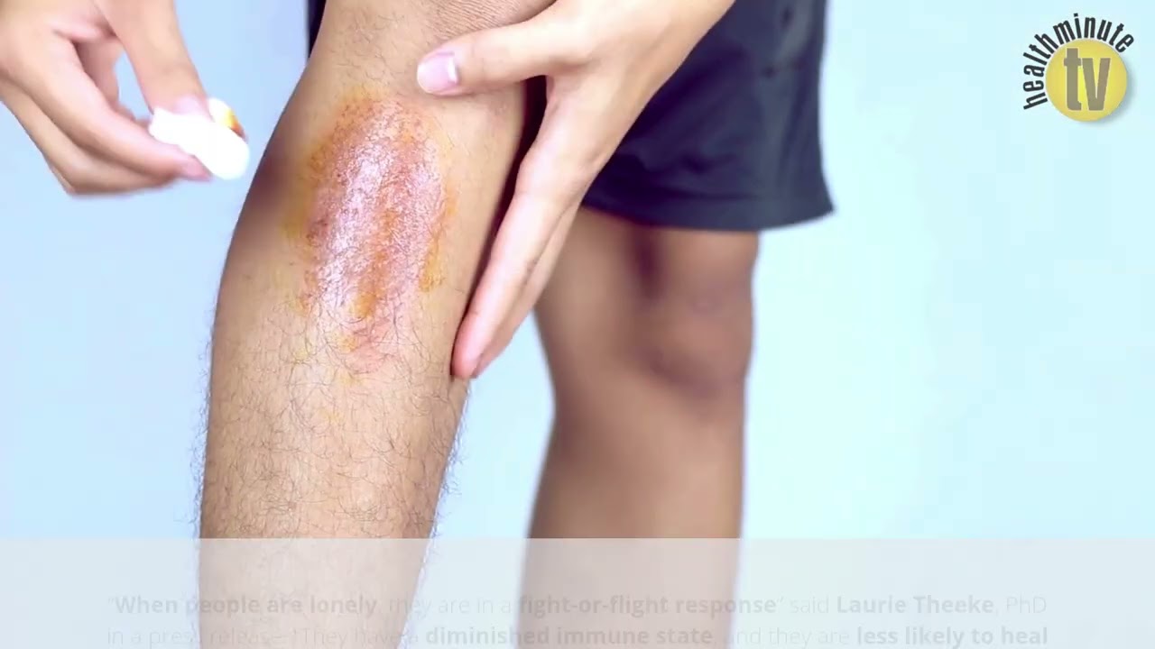 VIDEO: Loneliness linked to inflammation, delayed healing in wound care patients