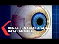 Apa Penyebab Katarak pada Mata?