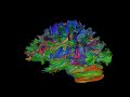 Networks in the brain: mapping the connectome