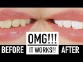 Whiten Teeth Instantly With MAKEUP?! ♥ Wengie
