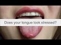 Does your tongue look stressed? Best Acupuncture School in Canada. Calgary, Alberta