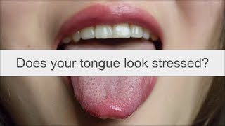 Does your tongue look stressed? Best Acupuncture School in Canada. Calgary, Alberta