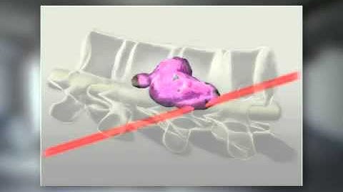 Spine Xsight Animation