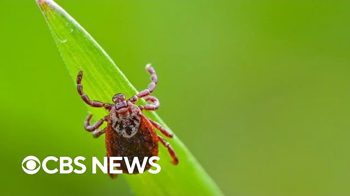 How to avoid Lyme disease during tick season