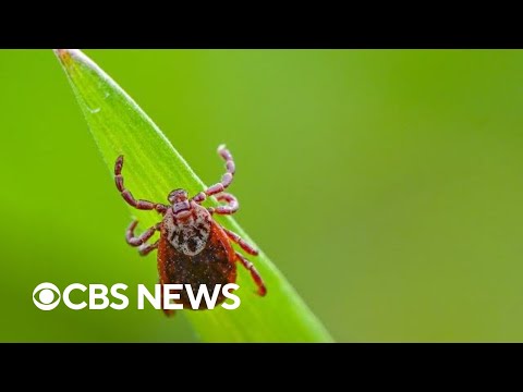 How to avoid Lyme disease during tick season