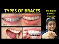Types of braces -pros and cons|best braces for teeth