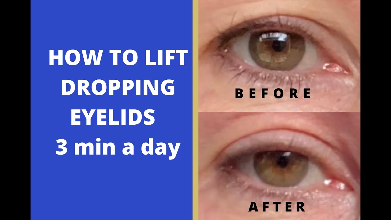 How to lift dropping eyelids 3 min a day Yoga for face Elena Amani