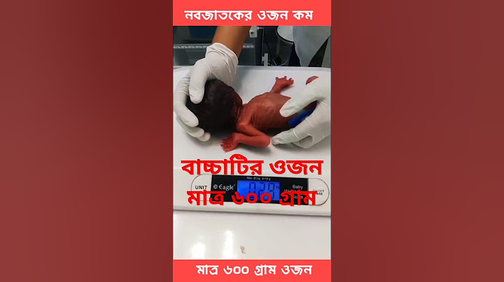 জন্মের সময় শিশুর কম ওজন | জন্মের সময় নবজাতকের ওজন কত হওয়া উচিত