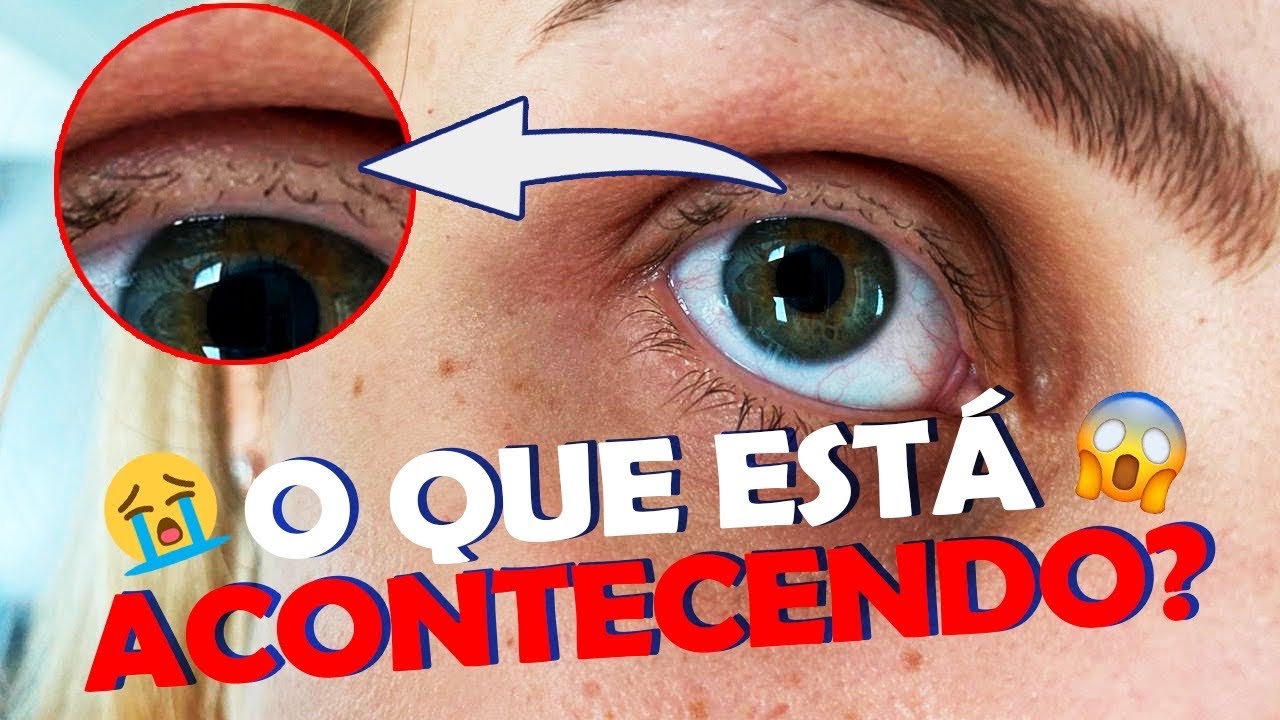 CAÍRAM TODOS OS MEUS CÍLIOS!