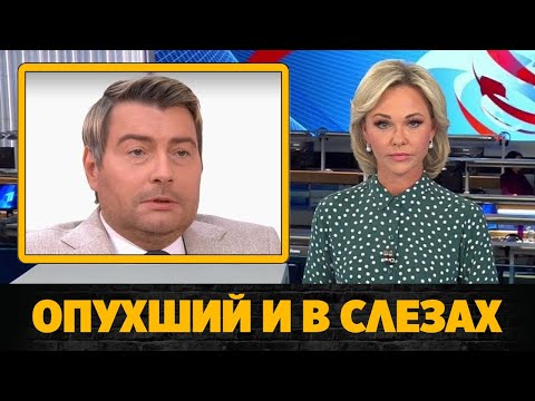 Что случилось с внешностью Николая Баскова