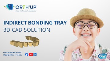 Indirect Bonding Trays: 3D printed for orthodontic brackets - ORTH