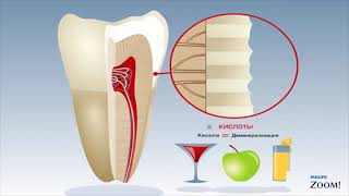Реминерализация эмали зубов.