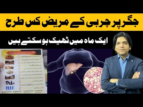 Best Diet For Fatty Liver Patients || Dr Affan Qaiser