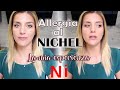 ALLERGIA al NICHEL - La mia Espereienza 💚