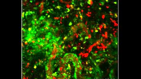 Real-time distribution and uptake of bisphophonate in 4T1 breast tumour