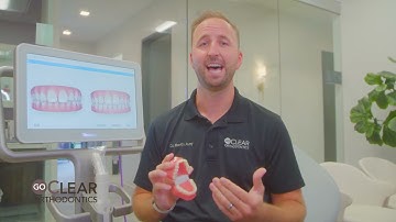 Invisalign Attachments Explained | GoClear Orthodontics