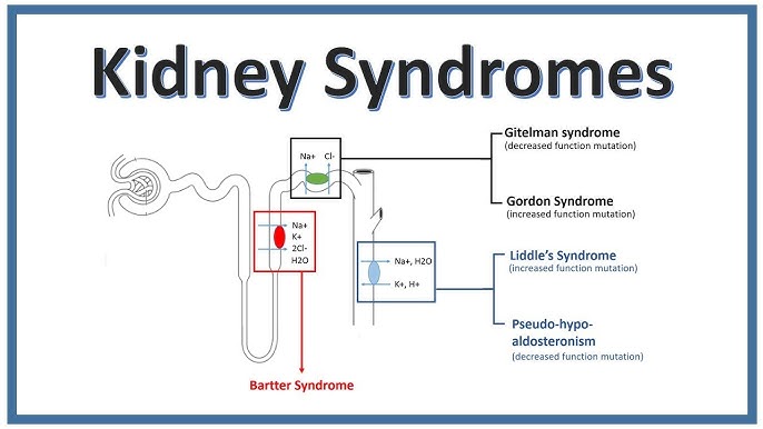 Bartter syndrome , Gitelman syndrome , Liddle's Syndrome | simplified for NEET PG | INICET - YouTube